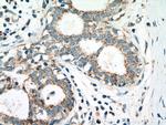 PITRM1 Antibody in Immunohistochemistry (Paraffin) (IHC (P))