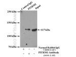 PITRM1 Antibody in Immunoprecipitation (IP)