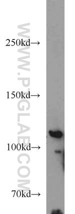 PITRM1 Antibody in Western Blot (WB)