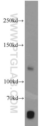 PITRM1 Antibody in Western Blot (WB)