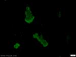 AKAP8L Antibody in Immunocytochemistry (ICC/IF)