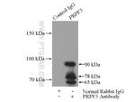 PRPF3 Antibody in Immunoprecipitation (IP)