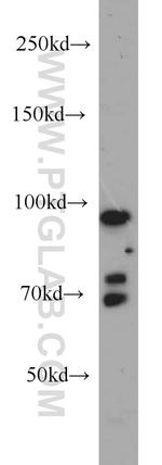 PRPF3 Antibody in Western Blot (WB)