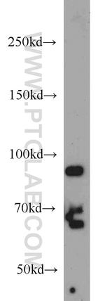 PRPF3 Antibody in Western Blot (WB)