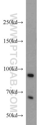 PRPF3 Antibody in Western Blot (WB)