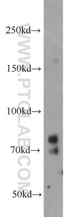 PRPF3 Antibody in Western Blot (WB)