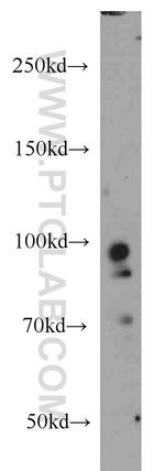 PRPF3 Antibody in Western Blot (WB)