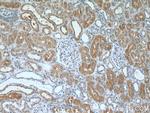 DAB2 Antibody in Immunohistochemistry (Paraffin) (IHC (P))