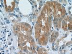 DAB2 Antibody in Immunohistochemistry (Paraffin) (IHC (P))