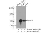 DAB2 Antibody in Immunoprecipitation (IP)