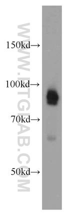 DAB2 Antibody in Western Blot (WB)