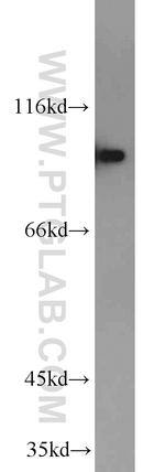 DAB2 Antibody in Western Blot (WB)