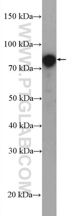 DAB2 Antibody in Western Blot (WB)