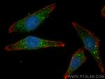 SNX6 Antibody in Immunocytochemistry (ICC/IF)