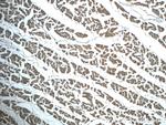 SNX6 Antibody in Immunohistochemistry (Paraffin) (IHC (P))