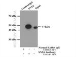 SNX6 Antibody in Immunoprecipitation (IP)