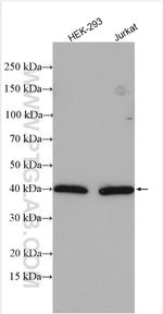 WDR77 Antibody in Western Blot (WB)