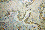 GDI2 Antibody in Immunohistochemistry (Paraffin) (IHC (P))