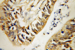 GDI2 Antibody in Immunohistochemistry (Paraffin) (IHC (P))