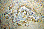 GDI2 Antibody in Immunohistochemistry (Paraffin) (IHC (P))