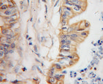 GDI2 Antibody in Immunohistochemistry (Paraffin) (IHC (P))