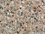 GDI2 Antibody in Immunohistochemistry (Paraffin) (IHC (P))