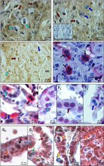 Glucocorticoid Receptor beta Antibody in Immunohistochemistry (IHC)