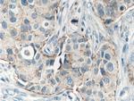 Claudin 7 Antibody in Immunohistochemistry (Paraffin) (IHC (P))