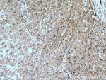 CDK2 Antibody in Immunohistochemistry (Paraffin) (IHC (P))