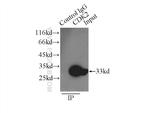 CDK2 Antibody in Immunoprecipitation (IP)