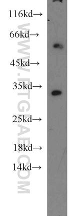 CDK2 Antibody in Western Blot (WB)