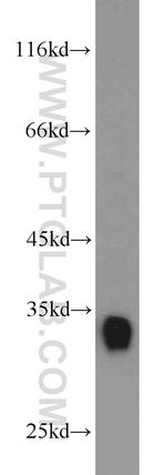 CDK2 Antibody in Western Blot (WB)