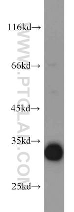 CDK2 Antibody in Western Blot (WB)