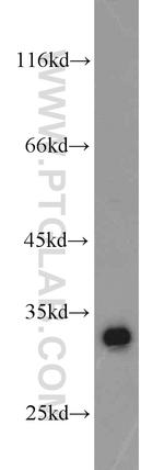 CDK2 Antibody in Western Blot (WB)