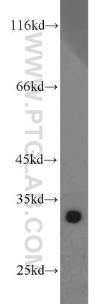 CDK2 Antibody in Western Blot (WB)