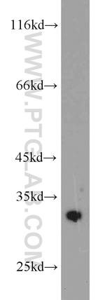 CDK2 Antibody in Western Blot (WB)