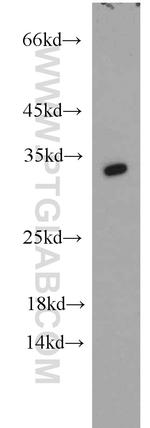 CDK2 Antibody in Western Blot (WB)