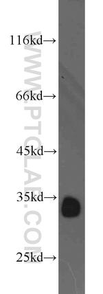 CDK2 Antibody in Western Blot (WB)