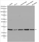 VGLL1 Antibody in Western Blot (WB)