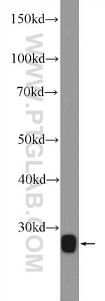 VGLL1 Antibody in Western Blot (WB)