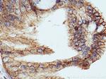 LRRC1 Antibody in Immunohistochemistry (Paraffin) (IHC (P))