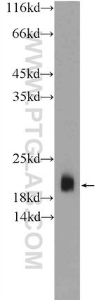 VAMP2 Antibody in Western Blot (WB)