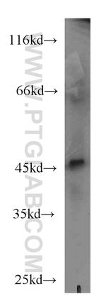 MNK1 Antibody in Western Blot (WB)