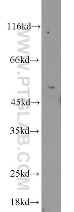 MNK1 Antibody in Western Blot (WB)