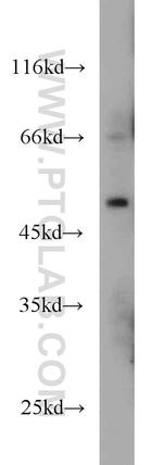 MNK1 Antibody in Western Blot (WB)