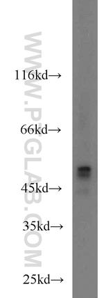 MNK1 Antibody in Western Blot (WB)