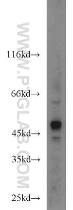 MNK1 Antibody in Western Blot (WB)