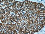 Cytokeratin 15 Antibody in Immunohistochemistry (Paraffin) (IHC (P))