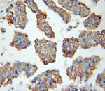 Cytokeratin 15 Antibody in Immunohistochemistry (Paraffin) (IHC (P))