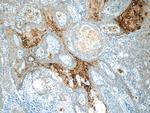 Cytokeratin 15 Antibody in Immunohistochemistry (Paraffin) (IHC (P))